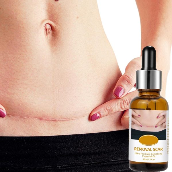 Acne Scar Removal Serum | Scar, C Section & Stretch Mark Removal Serum For Women