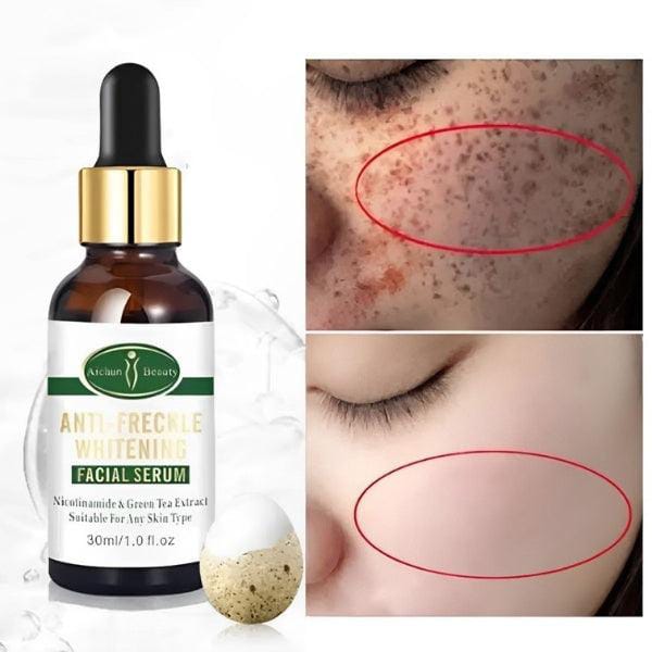 Aichun Anti Freckle Whitening Facial Serum 30ml