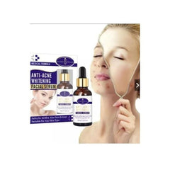 Anti-Acne Whitening Serum | Remove Acne Scars | 30ml