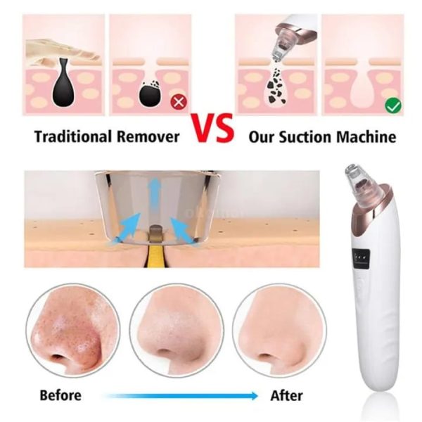 Face Vacuum & Blackhead Remover Pore Cleaner | Electric Deep Cleansing Tool For Nose & Face | U-Care