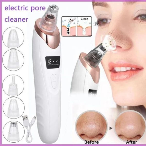 Face Vacuum & Blackhead Remover Pore Cleaner | Electric Deep Cleansing Tool For Nose & Face | U-Care