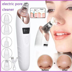 Face Vacuum & Blackhead Remover Pore Cleaner | Electric Deep Cleansing Tool For Nose & Face | U-Care