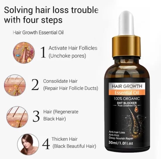 Ginger Hair Care Growth Serum | Hair Dry Frizzy Essence Anti Hair Loss Essential Oil