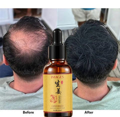 Hair Growth Serum 30ml